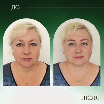 Перманентний макіяж брів
                    Мастер перманентного макияжа Наталя Харьков