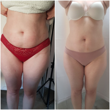 Наталя Кудряшова, Чернівці Фото - 41