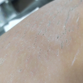 PlasmaLift
                    Массажист Любовь Одесса