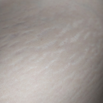 PlasmaLift
                    Массажист Любовь Одесса