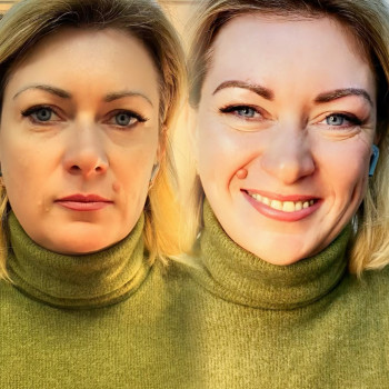 Анастасія Некрасова, Рівне Фото - 1