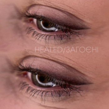 Загоєні стрілки з розтушовкою