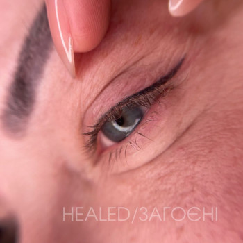 Загоєні стрілки