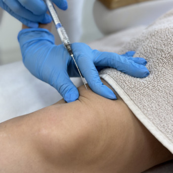 Molodist, Киев Фото - 9