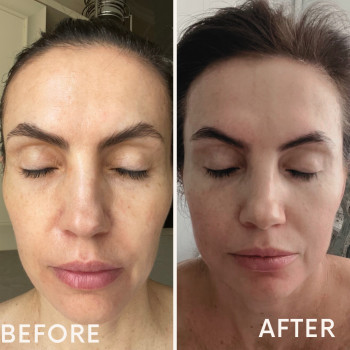 три сеанси масажу обличчя