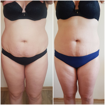 KUDRYASHOVA massage, Чернівці Фото - 14