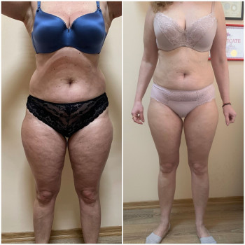 KUDRYASHOVA massage, Чернівці Фото - 17