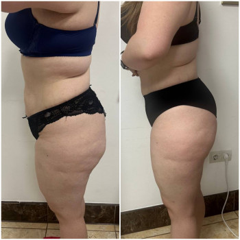 KUDRYASHOVA massage, Чернівці Фото - 19