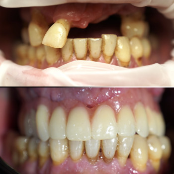 Твій стоматолог, Київ Фото - 9