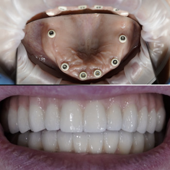 Твій стоматолог, Київ Фото - 11