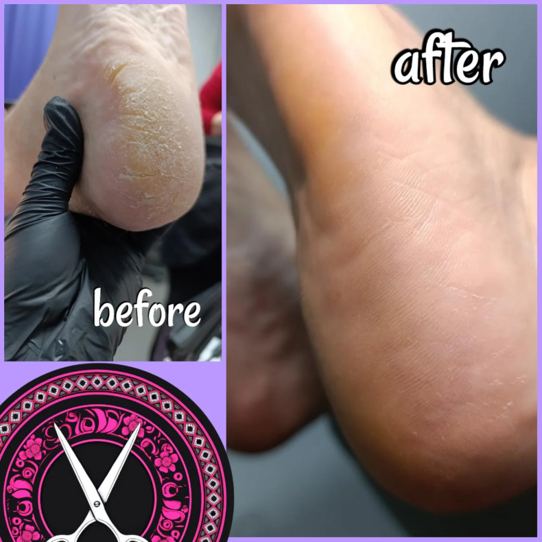 Педикюр #салонкрасотызапорожье #парикмахерскаязапорожье #наращиваниеногтей #маникюрзапорожье #маникюр #гельлак #окрашивание #стрижказапорожье, фото - Салон красоты Иленто