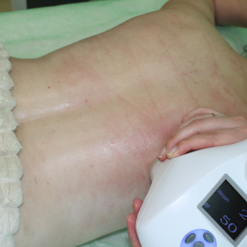 Антицелюлітний Vela Shape масаж.
                    Медичний центр Микамед Харків