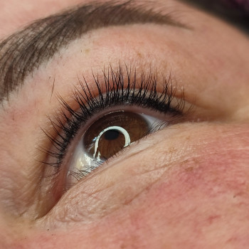 Загоєна міжвійка