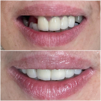 Дарія Яшатова, Черкаси Фото - 5