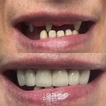 Дарія Яшатова, Черкаси Фото - 6