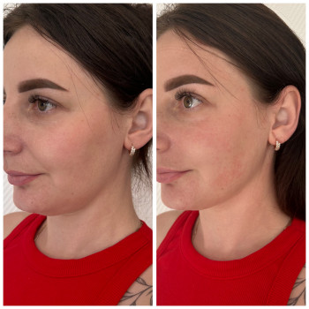 Юлия Злочевская, Белая Церковь Фото - 3