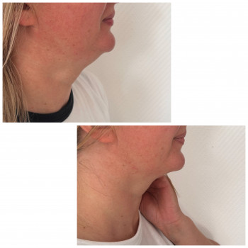 Юлия Злочевская, Белая Церковь Фото - 5