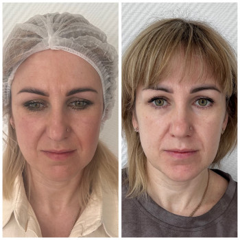 Юлия Злочевская, Белая Церковь Фото - 6