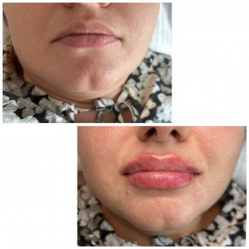 Юлия Злочевская, Белая Церковь Фото - 7