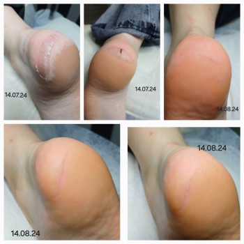 Людмила Матусевичи, Житомир Фото - 7