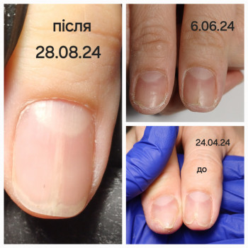 Людмила Матусевичи, Житомир Фото - 8