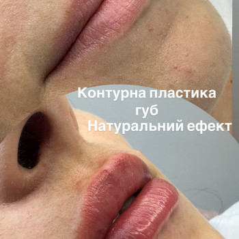 Збільшення габ