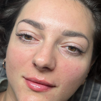 Після натуральний обʼєм