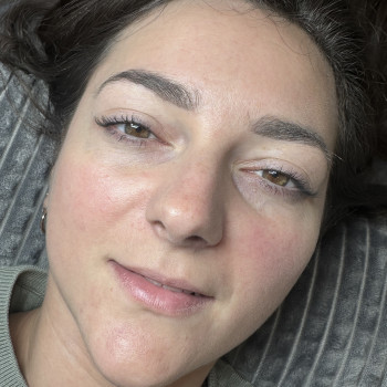 До збільшення губ