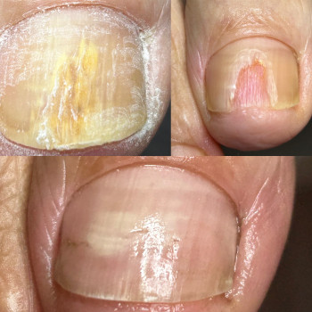 Оксана Рибинська, Овруч Фото - 10