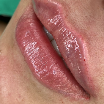 Увеличения губ
                    Мастер перманентного макияжа Любовь Одесса