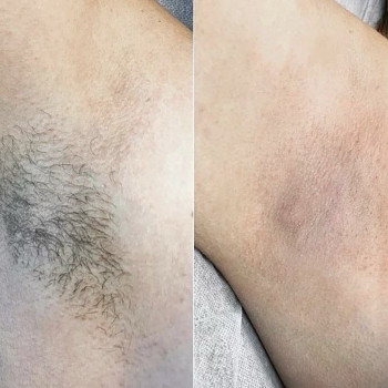 Ольга Овсяннікова, Одесса Фото - 3