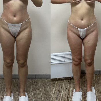 Ганна Міщенко, Київ Фото - 15