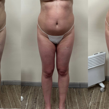 Ганна Міщенко, Київ Фото - 13