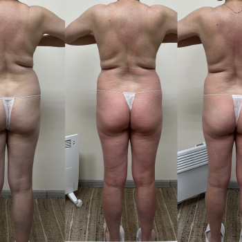 Ганна Міщенко, Київ Фото - 12