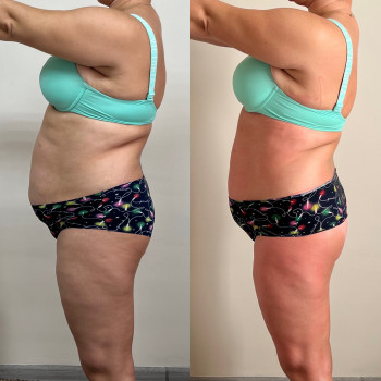 Ганна Міщенко, Київ Фото - 8