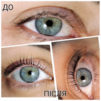 LILIIA SIABRENKO, Кривой Рог Фото - 5