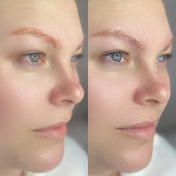 Видалення татуажу
                    Мастер перманентного макияжа Ксения Полтава