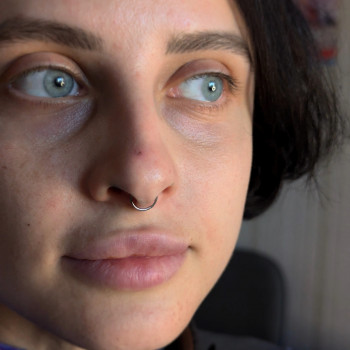 Прокол септум