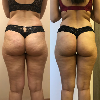 Марія Хропункова, Одеса Фото - 6