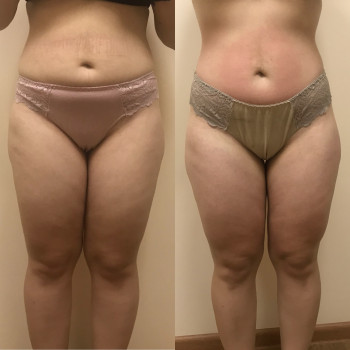 Марія Хропункова, Одеса Фото - 7