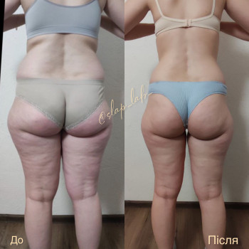 Марія Хропункова, Одеса Фото - 10