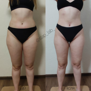 Марія Хропункова, Одеса Фото - 11