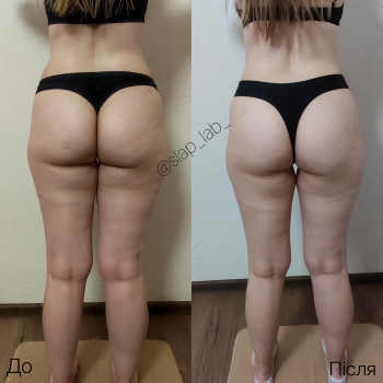 Марія Хропункова, Одеса Фото - 12