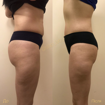 Марія Хропункова, Одеса Фото - 14