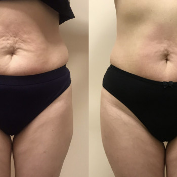 Марія Хропункова, Одеса Фото - 15