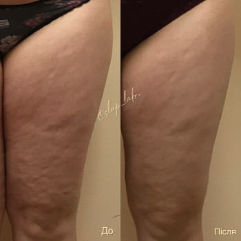 Марія Хропункова, Одеса Фото - 16