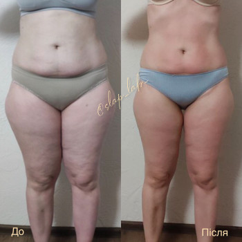 Марія Хропункова, Одеса Фото - 17