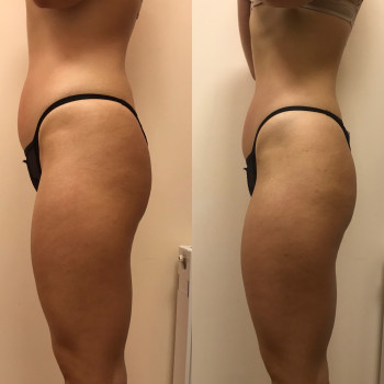 Марія Хропункова, Одеса Фото - 18