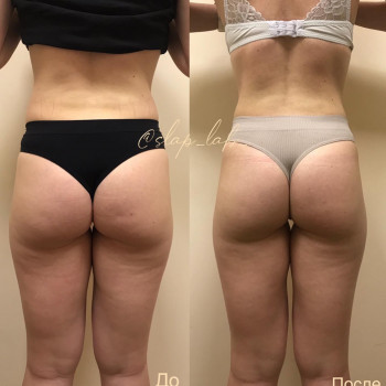 Марія Хропункова, Одеса Фото - 20