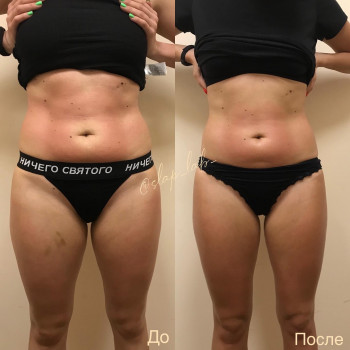 Марія Хропункова, Одеса Фото - 22